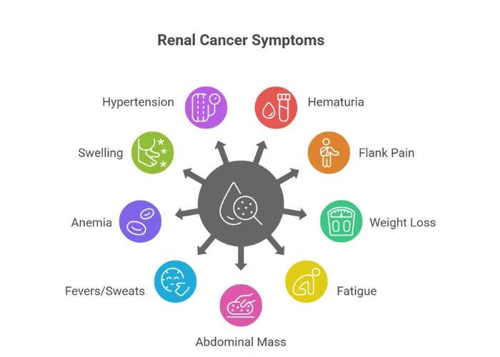 Symptoms of Renal Cancer